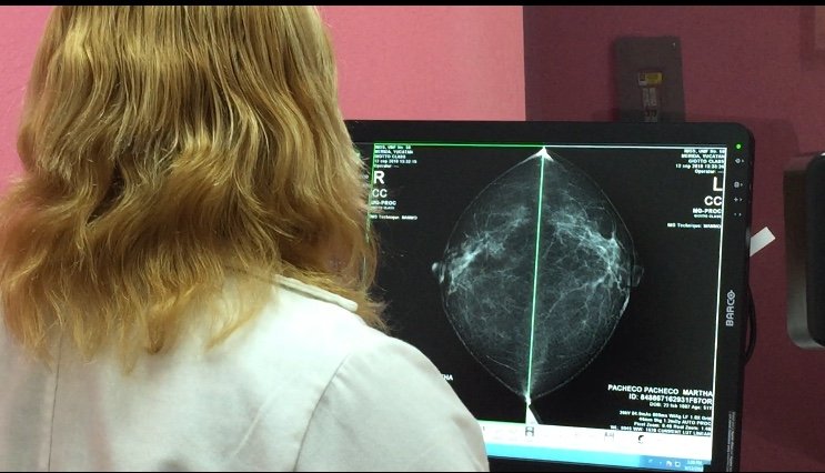 El IMSS invita a derechohabientes a realizarse mastografías y el Papanicolaou