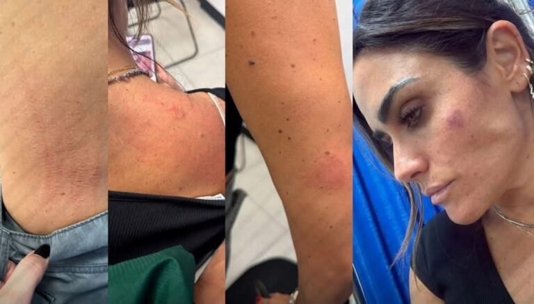 Alessandra Rojo de la Vega denuncia agresión durante operativo contra ambulantes en San Cosme